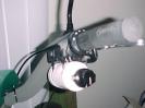 Throttle knob